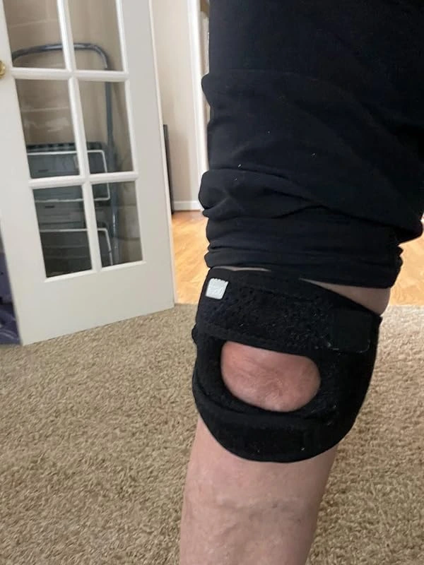 Foto de pies con corrector de juanetes