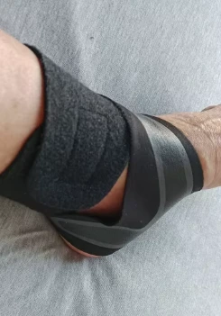 Foto de pies con corrector de juanetes