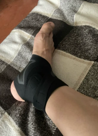 Foto de pies con corrector de juanetes