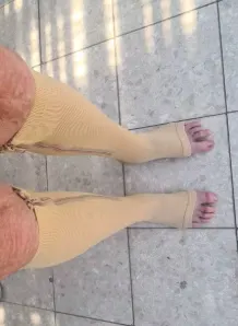 Foto de pies con corrector de juanetes