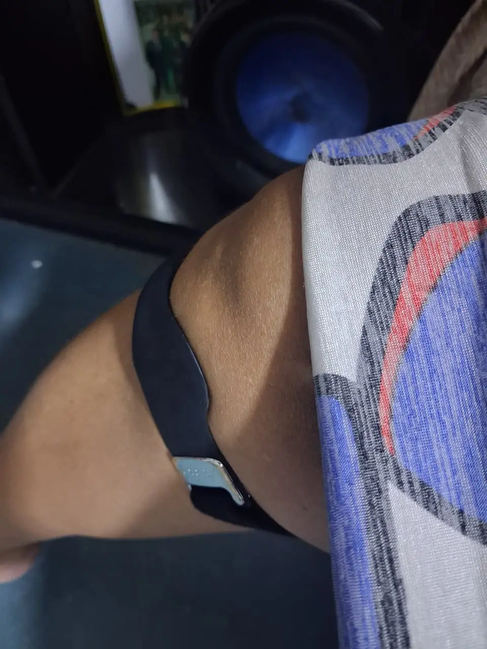 Foto de pies con corrector de juanetes