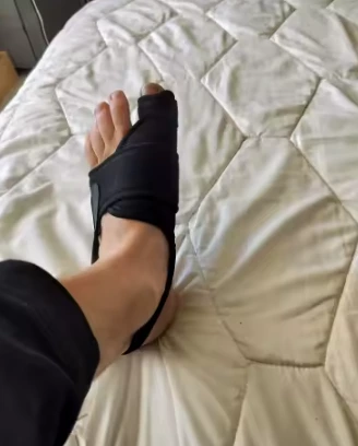 Foto de pies con corrector de juanetes